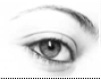 Blefaroplastia
